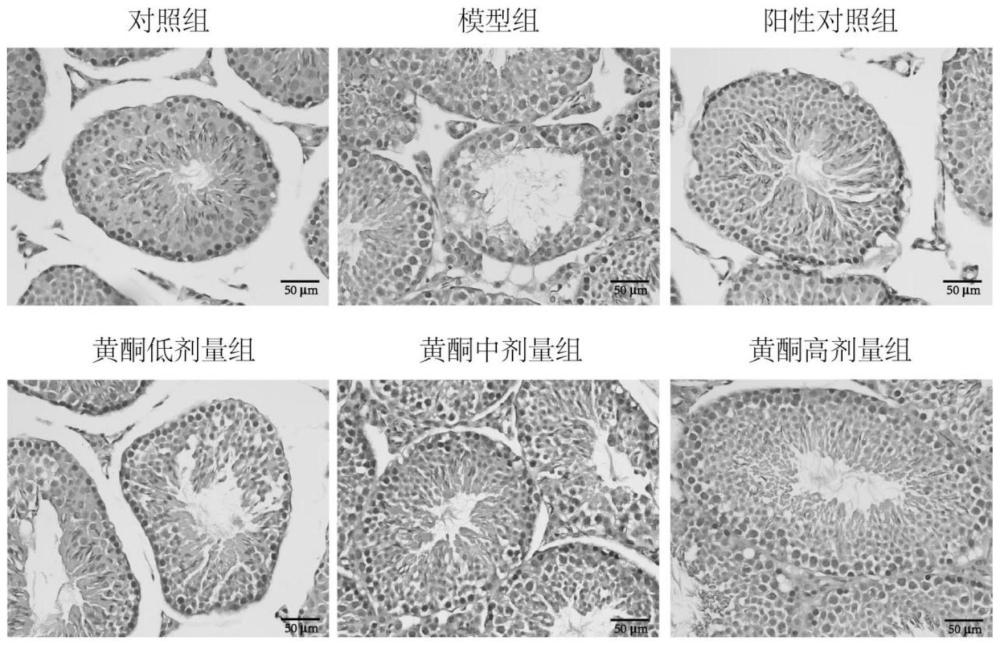 女贞子黄酮提取物在制备少弱精症治疗药物中的应用