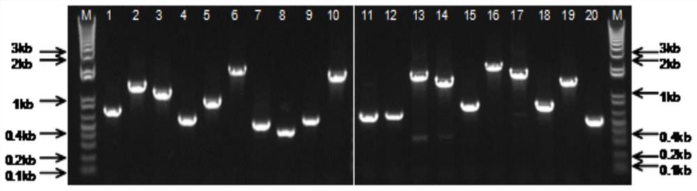 一种棘阿米巴特异性抗原肽、多克隆抗体及其用途