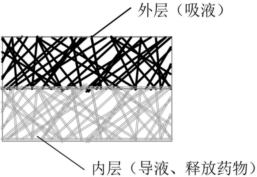 一种抗炎促愈电纺丝伤口敷料、制备方法及其应用