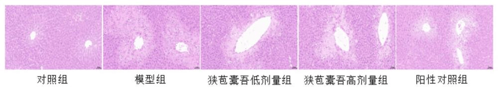 狭苞橐吾醇提物在制备预防或治疗药物性肝损伤的药物中的应用